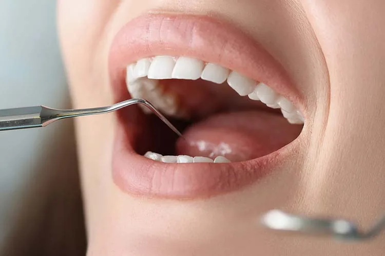 Featured image for the article: Scaling & Root Planing Explained (Deep Cleaning) — Woodbridge, VA