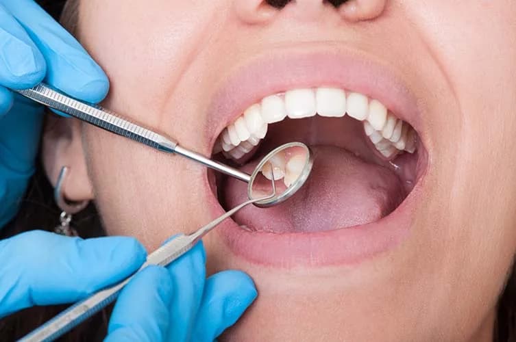 Featured image for the article: Tooth Extraction Aftercare in Woodbridge, VA
