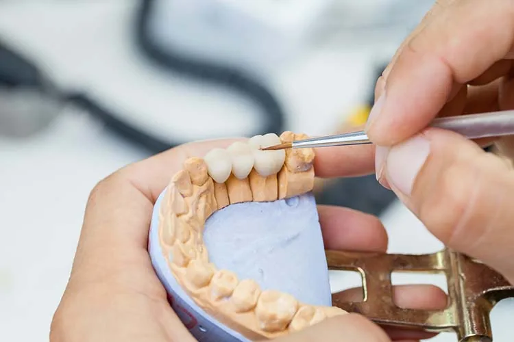 Prosthodontic Dentistry — photo representing this service at Hedgewood Dental, Woodbridge VA