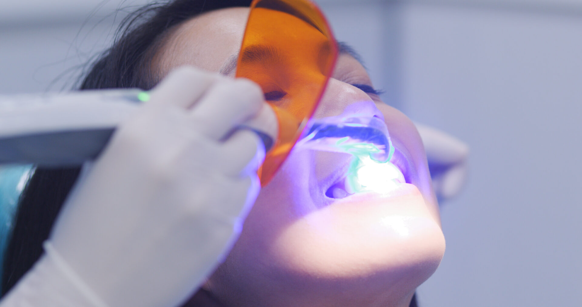Dentist using dental curing UV lamp on teeth of patient